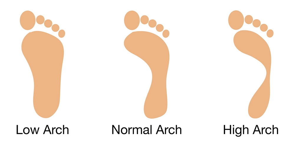 type-boog-haskey-hasselt